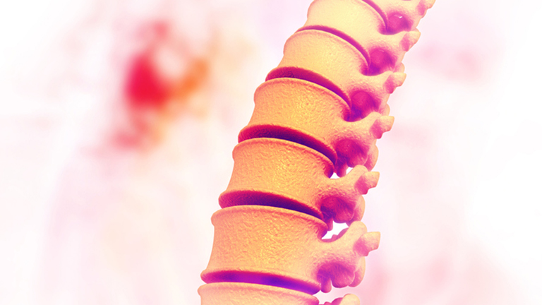  The Effect of a High-Protein Diet on Bone Health