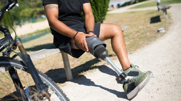  Estimating BMI for Patients with Amputations