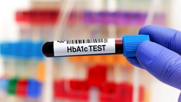 Is the Hemoglobin A1c Test Used to Diagnose Diabetes?