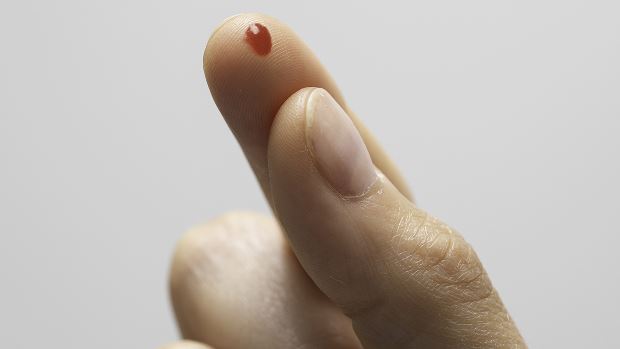 Patient with diabetes getting blood sampling done from finger prick.